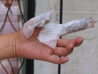 Balance quemados con pólvora