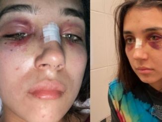 “Me decía que un demonio se le metía”: Joven denunció golpes y abuso de su ex
