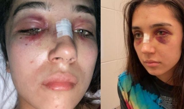 “Me decía que un demonio se le metía”: Joven denunció golpes y abuso de su ex