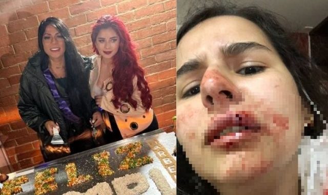 Hija de Marbelle dio la cara tras ser señalada de agresión1