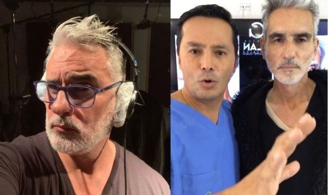 Miguel Varoni se lastimó la cirugía de abdomen