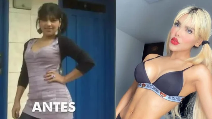 La Barbie Colombiana dio detalles de su aclaramiento de piel