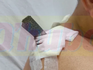 El delincuente atacó al adulto mayor con 2 cuchillos al mismo tiempo.
