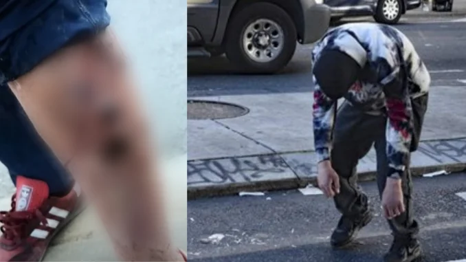 El 'tranq' es un fármaco que genera un efecto 'zombie' potente y duradero, pero con consecuencias devastadoras.