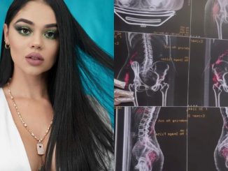 esta-podrido-la-segura-muestra-como-esta-su-cuerpo-por-los-biopolimeros