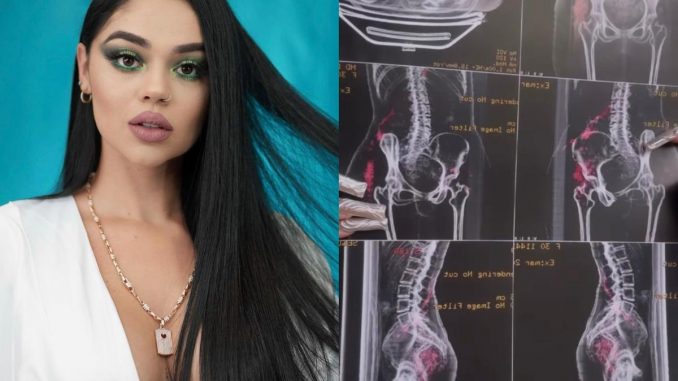 esta-podrido-la-segura-muestra-como-esta-su-cuerpo-por-los-biopolimeros