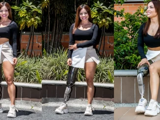 Paola Montoya modelo con prótesis
