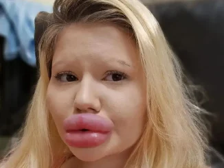 Andrea-Ivanova-la-mujer-con-los-labios-mas-grandes-del-mundo