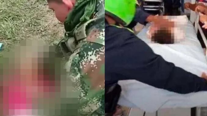 Habló el soldado que trató de salvar a la niña asesinada en Huila